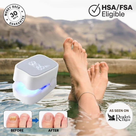 gobuy™ - Nail Fungus Laser Device